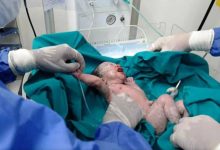 Photo of أول حالة ولادة لمصابة بكورونا بالمستشفيات التعليمية بالقاهرة