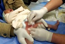 Photo of أب يتهم طبيب في طوخ ببتر قضيب نجله أثناء جراحة الختان