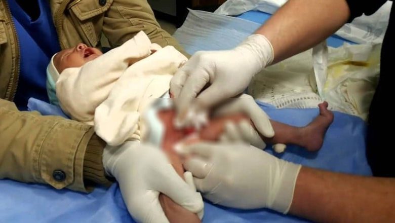 Photo of أب يتهم طبيب في طوخ ببتر قضيب نجله أثناء جراحة الختان