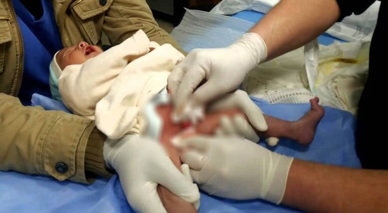 أب يتهم طبيب في طوخ ببتر قضيب نجله أثناء جراحة الختان
