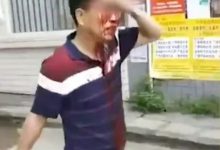 Photo of إصابة 40 شخصا في هجوم بسكين استهدف روضة أطفال جنوبي الصين