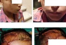 Photo of “شكاوى الوزراء” تستجيب لطلب إجراء جراحة تجميلية لطفل