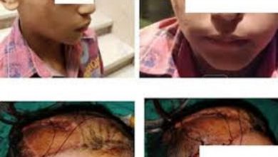 Photo of “شكاوى الوزراء” تستجيب لطلب إجراء جراحة تجميلية لطفل