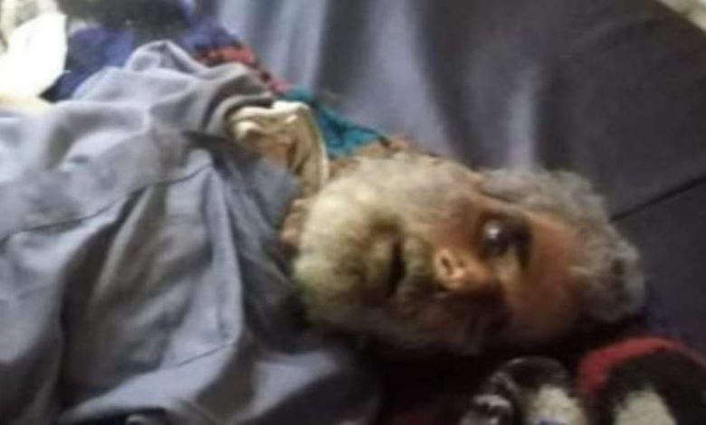 Photo of التدخّل السريع ينقذ مسن بلا مأوى مصاب بكورونا فى الغربية