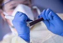 Photo of ألمانيا تسجل أكثر من 23 ألف إصابة جديدة بكورونا خلال 24 ساعة