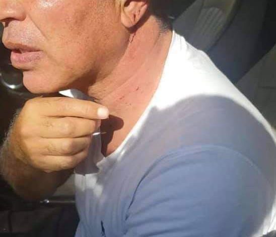 Photo of شاهد بالصور.. الإعتداء على أيمن يونس عقب صلاة الجمعة