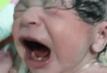 Photo of “حالة نادرة” ولادة طفلة بـ”سنتين” في سوهاج
