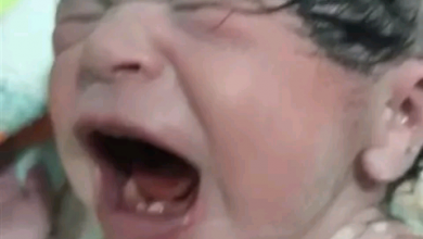 Photo of “حالة نادرة” ولادة طفلة بـ”سنتين” في سوهاج