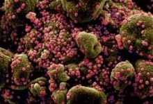 Photo of الصحة الكويتية تسجل 899 إصابة و5 وفيات بفيروس كورونا خلال 24 ساعة