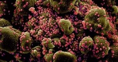 Photo of الصحة الكويتية تسجل 899 إصابة و5 وفيات بفيروس كورونا خلال 24 ساعة