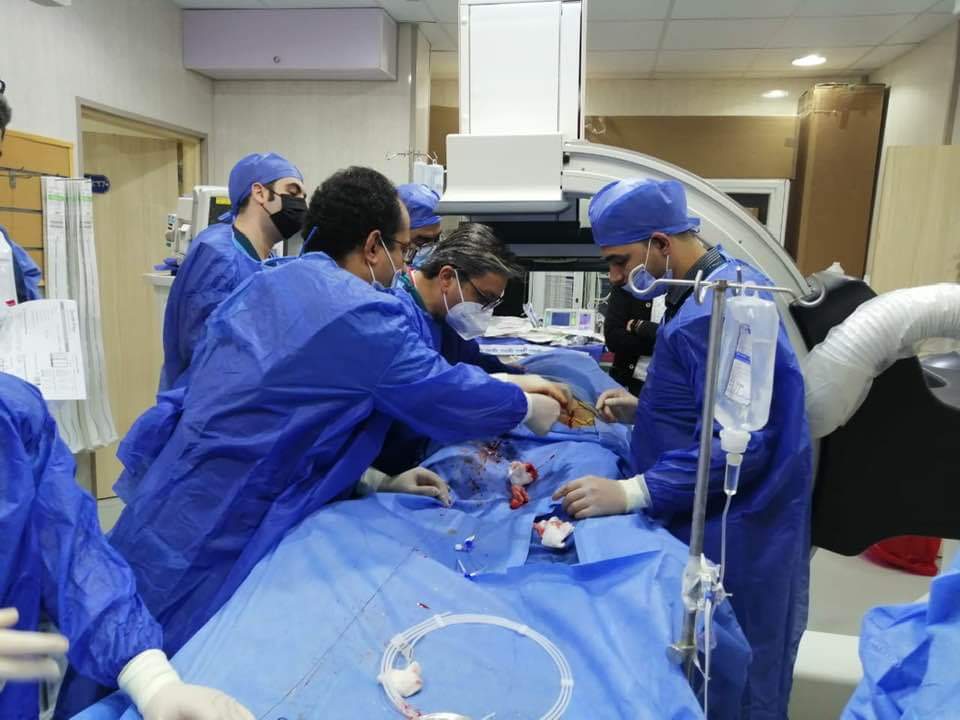 لأول مرة.. تركيب دعامة بالاورطي لمسن دون تدخل جراحي ببنها الجامعي