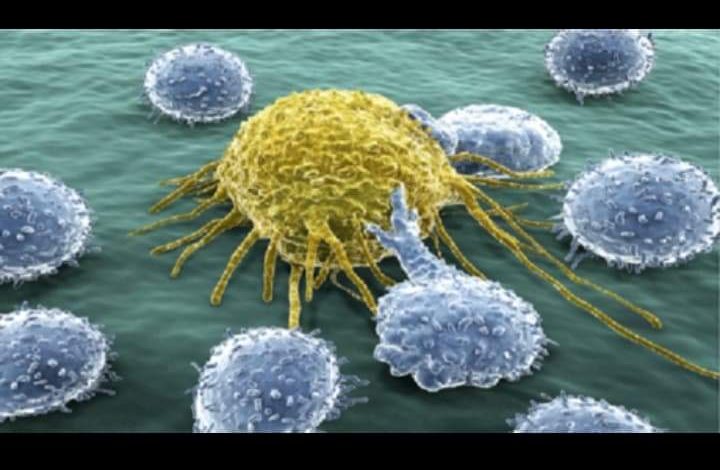 Photo of علامة تحذير تدل على الإصابة بسرطان “البنكرياس”