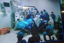 Photo of إجراء أول عملية زراعة القرنية بمستشفيات جامعة بنها