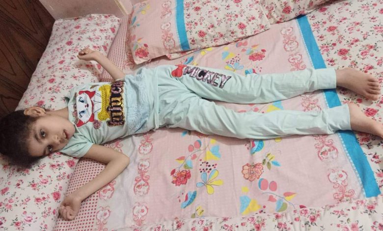 Photo of بعد موت شقيقتها بنفس المرض..الطفلة جنة تنتظر الموت فهل يتدخل وزير الصحة