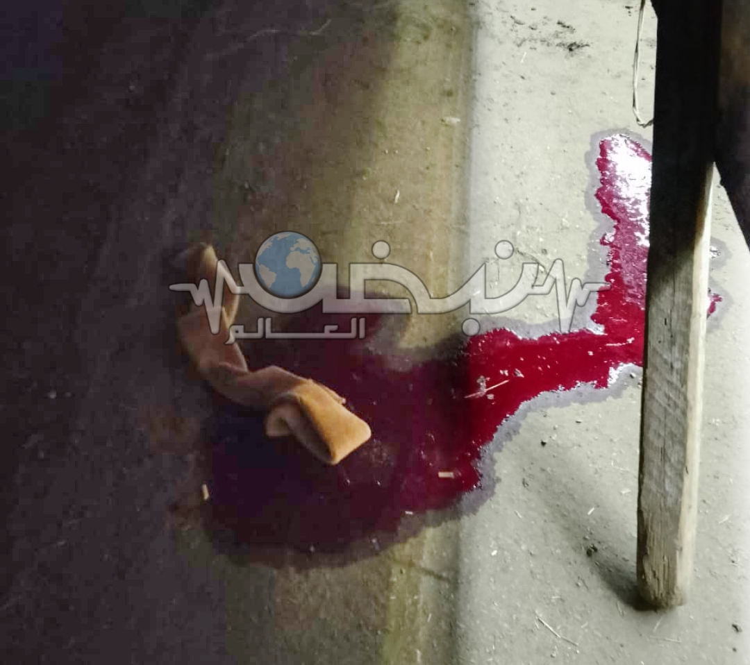 مصرع أمين شرطة اثر دهسة بسيارة ميكروباص في نقطة تمركز امني لكنيسة في بنها متابعة: وائل جمال - كتبت: الهام السيد لقى أمين شرطة مصرعهم - منذ قليل اليوم الخميس- عقب صدمه في حادث سير من سيارة ميكروباص مسرعة في في نقطة تمركز أمني بجوار مقابر المسيحيين بطريق عزبة المتيني- الشموت ببنها بمحافظة القليوبية، أثناء عمله بالنقطة. تلقت مديرية أمن القليوبية إخطارًا من غرفة عمليات النجدة عن مصرع أمين شرطة في حادث تصادم بنقطة التمركز الامني بطريق عزبة المتيني - الشموت. وأوضحت التحريات ان أمين الشرطة ويدعى (خالد والي) كان يقوم بخدمة عمله واثناء وضعه الحواجز الحديدية، صدمته سيارة تحمل لوحة معدنية برقم (ق ط ج ٢٦٣٤) كان يقودها شاب في اوساط العشرينات من عمره يدعى ( ع. الوادي). وبانتقال ضباط المباحث وبالفحص، وبسؤال قائد السيارة ادعى ان السيارة ليس بها فرامل وبالفحص الأولي تبين عدم صحة كلامه وان السيارة بها فرامل تعمل بشكل طبيعي، وتبين أن سبب الحادث، هي السرعة الزائدة لقائد السيارة. وتم التحفظ علي قائد السيارة في قسم أول بنها، ونقل السيارة الي المضبوطات وتحرر محضرًا بالواقعة، مع إتخاذ الإجراءات القانونية لعرض المتهم على النيابة العامة لمباشرة التحقيقات.